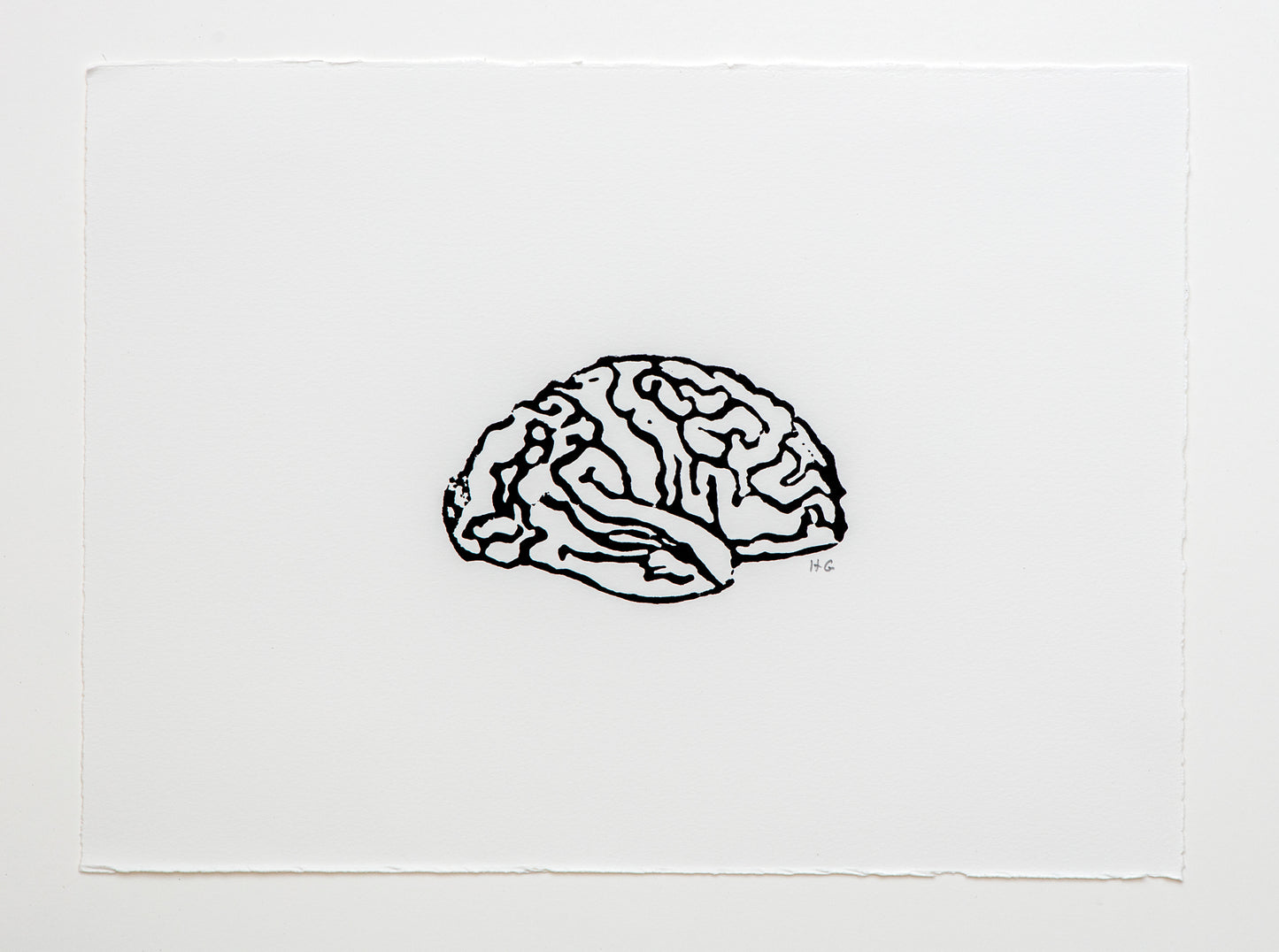 Brain